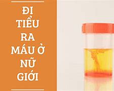 Đi Tiểu Ra Máu Ở Nữ Giới Là Bệnh Gì